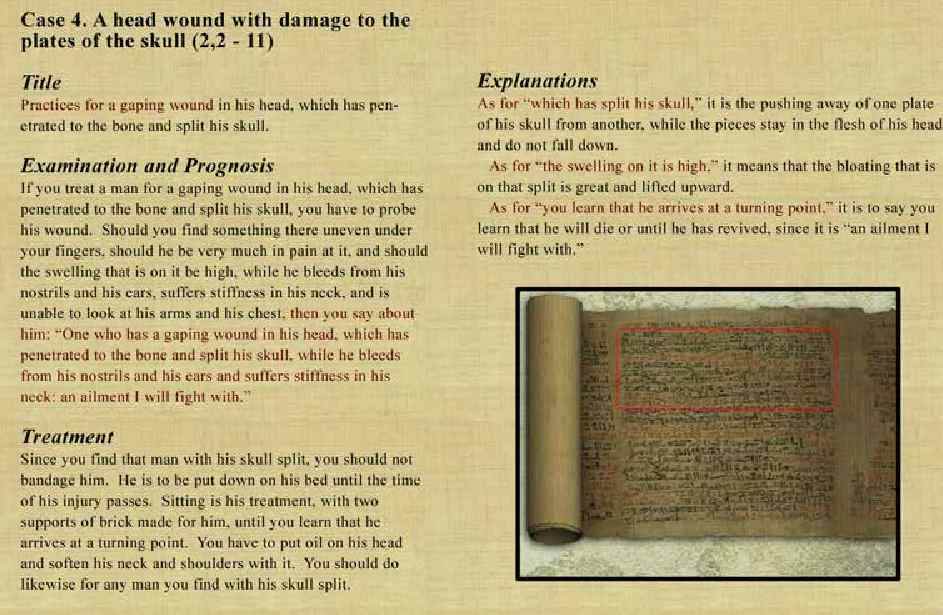 case4 ancient egyptian papyrus gaping wound head injury treatment
